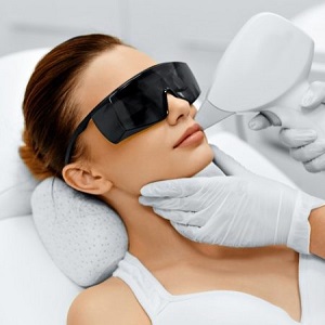 laser hair removal